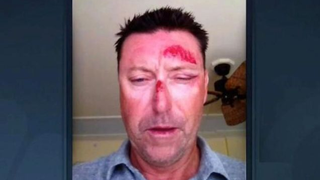 Robert Allenby Spent $3,400 At A Strip Club On Night Of Alleged Attack